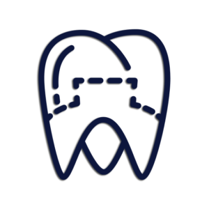 Ortodonzia fissa e intercettiva a Catania Studio Dentistico Palmeri