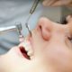 pulizia denti studio palmeri dentisti catania