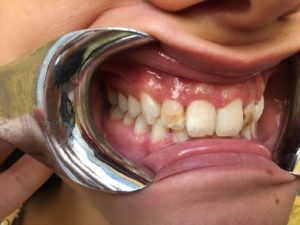 Odontoiatria protesica estetica a Catania Studio Dentistico Palmeri