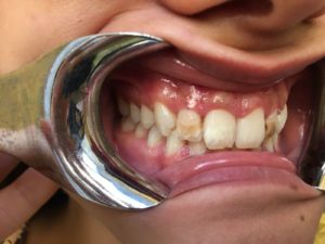 Odontoiatria protesica estetica a Catania Studio Dentistico Palmeri