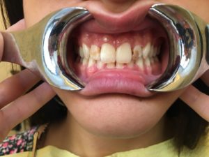 Odontoiatria protesica estetica a Catania Studio Dentistico Palmeri