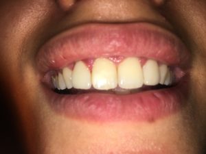 Odontoiatria protesica estetica a Catania Studio Dentistico Palmeri