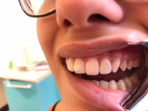 Odontoiatria protesica estetica a Catania Studio Dentistico Palmeri