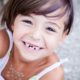 Cosa fare quando tuo figlio perde precocemente un dente?