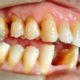Endodonzia e conservativa a Catania Studio Dentistico Palmeri