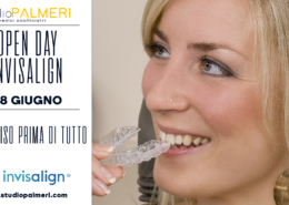 Open day Invisalign a Catania Studio Palmeri