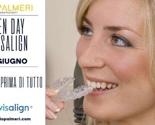 Open day Invisalign a Catania Studio Palmeri