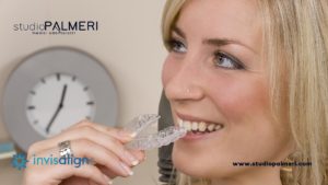 Prenota ora il tuo check up Invisalign a Catania Studio Dentistico Palmeri