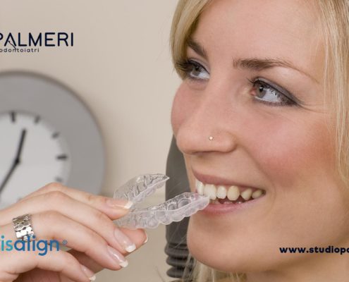 Prenota ora il tuo check up Invisalign a Catania Studio Dentistico Palmeri